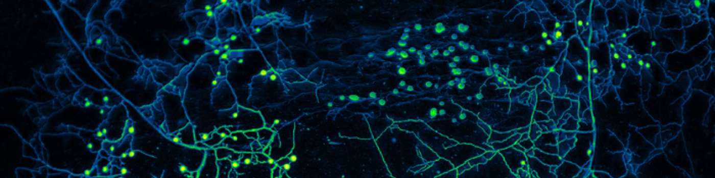 Beneficial Fungi Will Transform Your Gothic Garden Mycelium Of Arbuscular Mycorrhizal Fungi